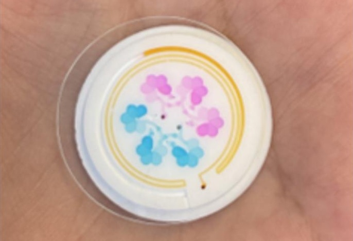 Imagen: el sensor de sudor microfluídico 3D de próxima generación rastrea cambios rápidos de biomarcadores con alta precisión (Foto cortesía de Da Som Yang/Universidad Chung-Ang)